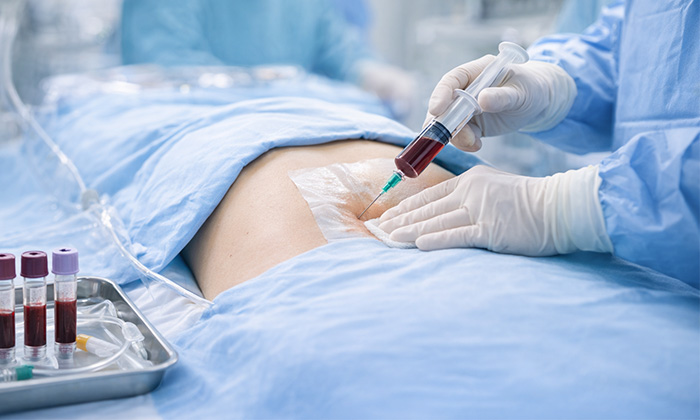 특수 치료(혈액 패치) 이미지